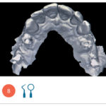 Fig. 8 Impronta digitale acquisita.