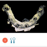 Fig. 9 Impronta digitale inferiore.