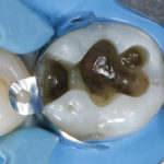 fig_10