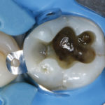 fig_11