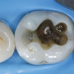 fig_13