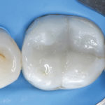 fig_15