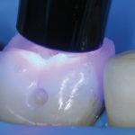 fig_16