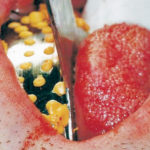 Fig. 3 Impronta in materiale siliconico dell’arcata inferiore.