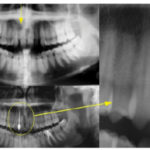 Fig. 13 Le radiografie del caso.
