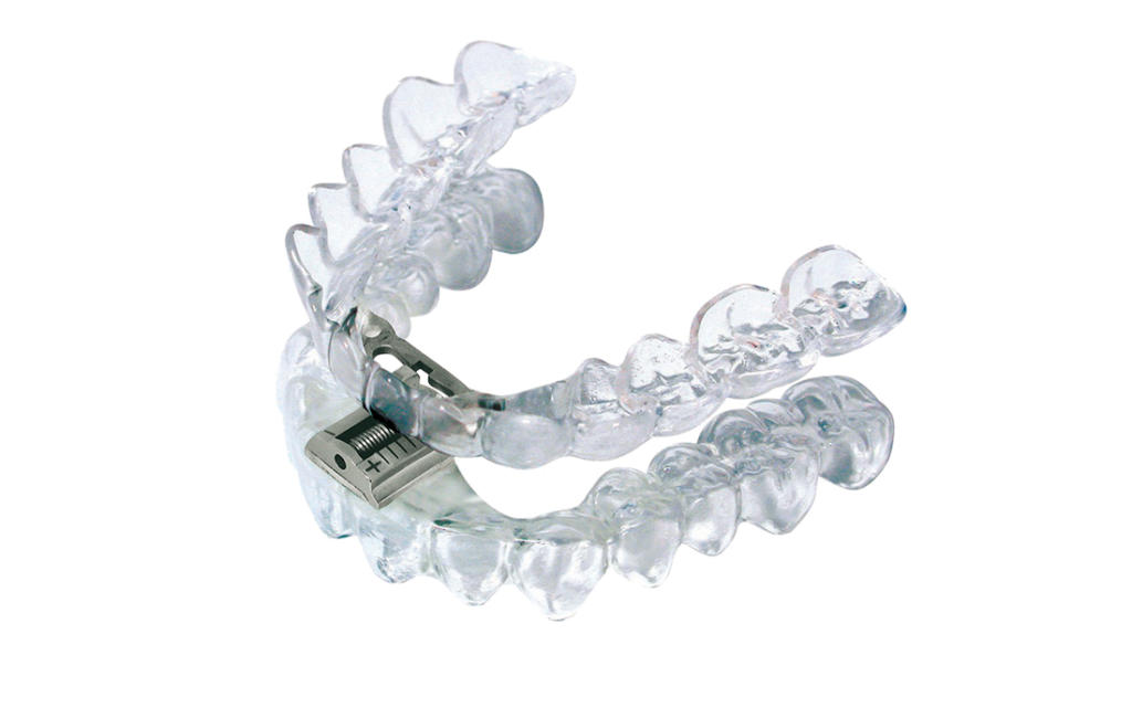 splint TAP