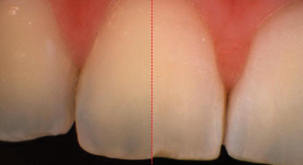 croma dentario
