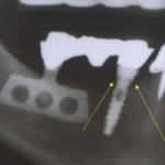 componenti-della-connessione