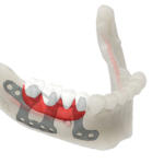 manufatto implantare progettatoinsede