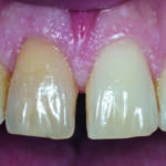 Fig. 1b Immagine clinica pre-operatoria.