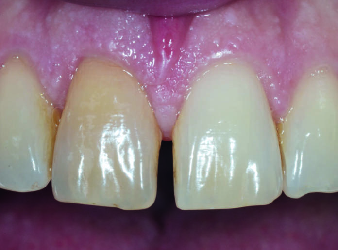 Fig. 1b Immagine clinica pre-operatoria.