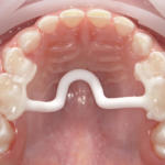 SHOFU DENTAL DIGITAL CAMERA