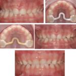 SHOFU DENTAL DIGITAL CAMERA