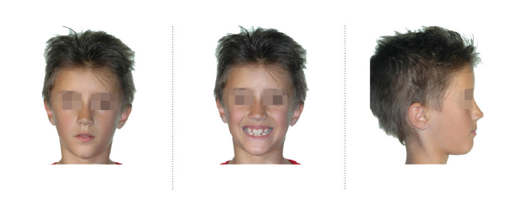 Foto del volto