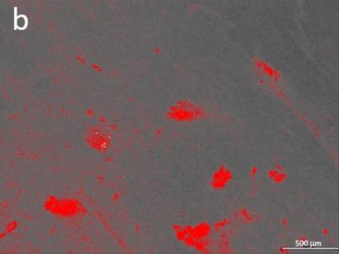 Fig. 5b Analisi allo stereomicroscopio e analisi mediante software con programma colorimetrico che evidenzia le aree con detriti di tessuto osseo residuo dopo l’osteotomia: strumenti rotanti tradizionali. Fig. 5b Analisi allo stereomicroscopio e analisi mediante software con programma colorimetrico che evidenzia le aree con detriti di tessuto osseo residuo dopo l’osteotomia: strumenti rotanti tradizionali.