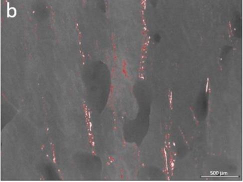 Fig. 6b Analisi allo stereomicroscopio e analisi mediante software con programma colorimetrico che evidenzia le aree con detriti di tessuto osseo residuo dopo l’osteotomia: laser Er:YAG modalità MSP (medium short pulse). Fig. 6b Analisi allo stereomicroscopio e analisi mediante software con programma colorimetrico che evidenzia le aree con detriti di tessuto osseo residuo dopo l’osteotomia: laser Er:YAG modalità MSP (medium short pulse).
