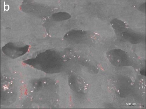 Fig. 7b Analisi allo stereomicroscopio e analisi mediante software con programma colorimetrico che evidenzia le aree con detriti di tessuto osseo residuo d-po l’osteotomia: laser Er:YAG modalità QSP (quantum square pulse). Fig. 7b Analisi allo stereomicroscopio e analisi mediante software con programma colorimetrico che evidenzia le aree con detriti di tessuto osseo residuo d-po l’osteotomia: laser Er:YAG modalità QSP (quantum square pulse).