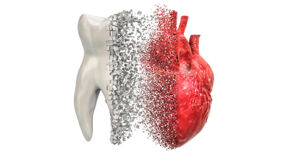 Malattie cardiovascolari ed endodonzia: lo stato dell’arte