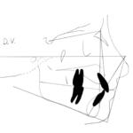 Fig. 12b Tracciato cefalometrico.