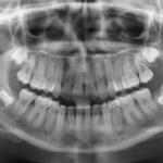 Fig. 15 OPT.