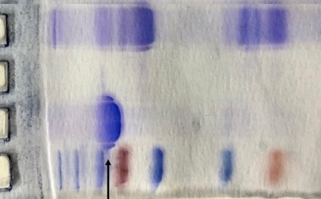 Attività antibatterica, anti-invasiva e antinfiammatoria della lattoferrina bovina estratta da colostro e da latte verso il colostro intero