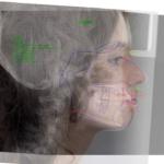 Fig. 1 Sovrapposizione TeleRx L-L, Tracciato e Fotografia del profilo