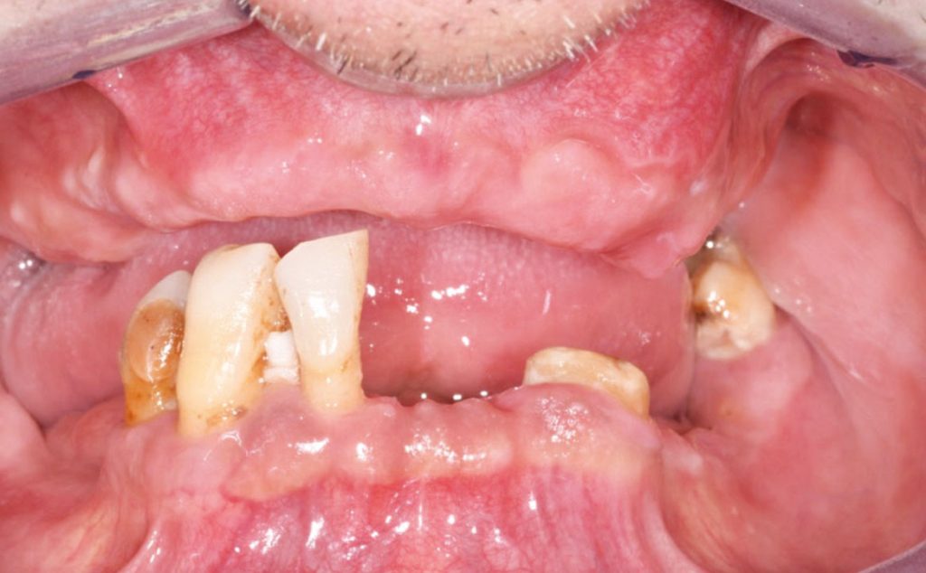 Fig. 1 Visione frontale pre-operatoria.