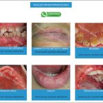 Fig. 5 View dell’atlante delle comuni reazioni avverse a farmaci in odontoiatria.