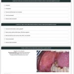Fig. 7B Self-E-learning, esempio di questionario di autovalutazione sulle reazioni avverse a farmaci in odontoiatria.