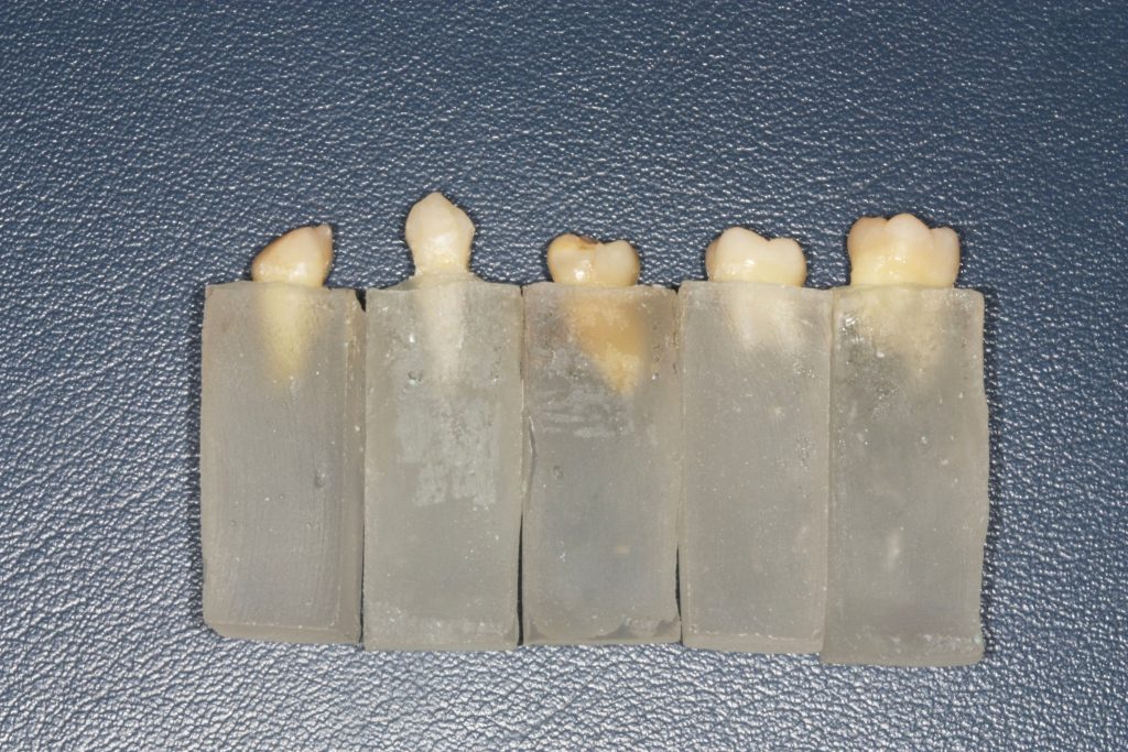 Fig. 1 Gruppo di campioni di denti immersi nei supporti di resina.