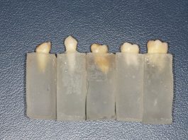 Fig. 1 Gruppo di campioni di denti immersi nei supporti di resina.