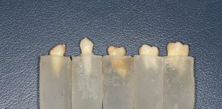 Fig. 1 Gruppo di campioni di denti immersi nei supporti di resina.