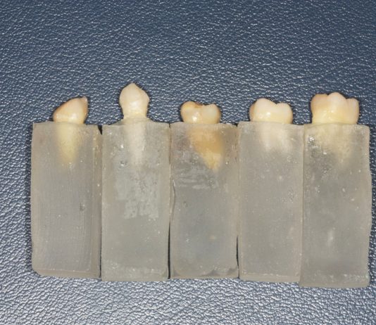 Fig. 1 Gruppo di campioni di denti immersi nei supporti di resina.
