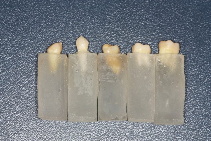 Fig. 1 Gruppo di campioni di denti immersi nei supporti di resina.