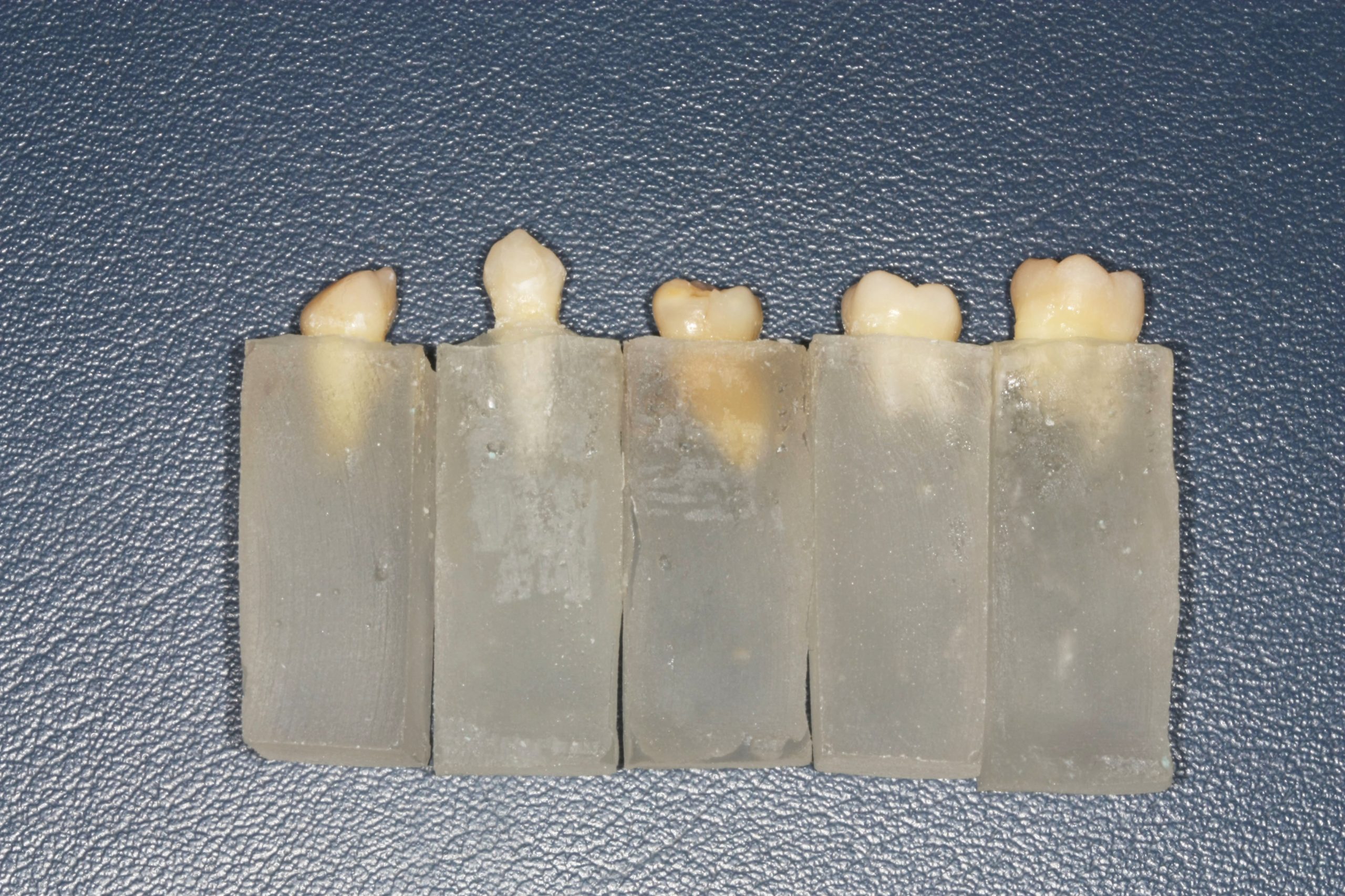 Fig. 1 Gruppo di campioni di denti immersi nei supporti di resina.