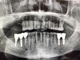 Fig. 1 Esame ortopantomografico di I livello.