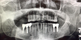 Fig. 1 Esame ortopantomografico di I livello.