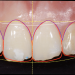 Fig. 2 Progetto Digital Smile Design.