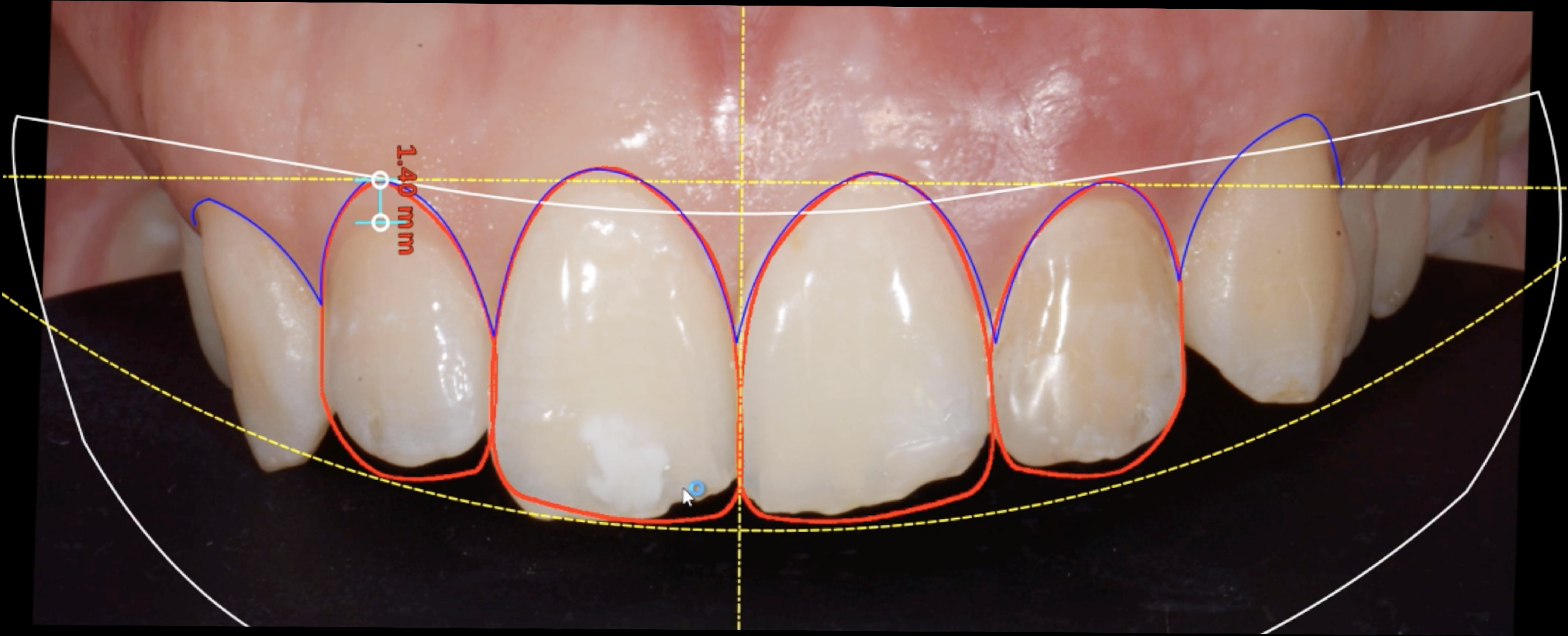 Fig. 2 Progetto Digital Smile Design.