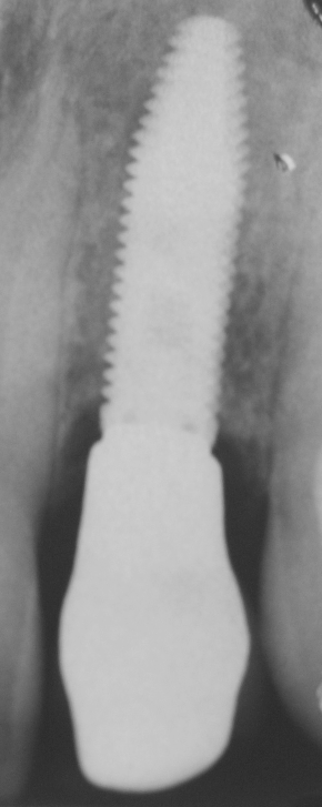 Fig. 5 Rx post guarigione.