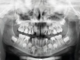 Fig. 1 Ortopantomografia: si evidenziava la presenza di elementi permanenti e decidui con trattamenti conservativi ed endodotontici.