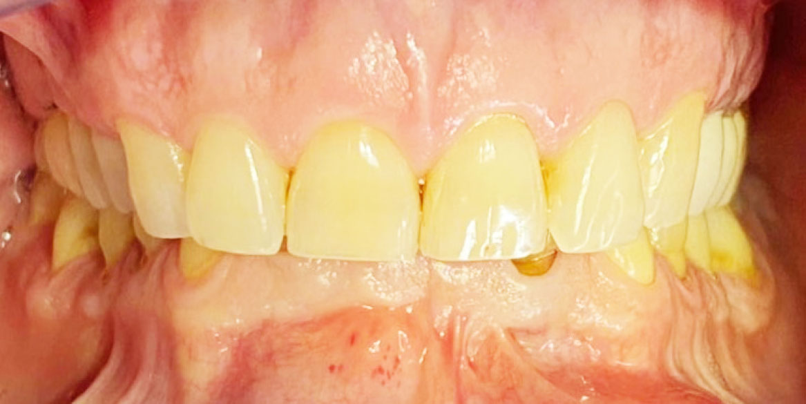 Fig. 1 Caso clinico iniziale, visione occlusale.