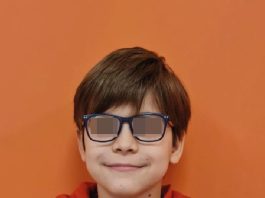 Fig. 1A Foto frontale iniziale.