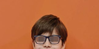 Fig. 1A Foto frontale iniziale.