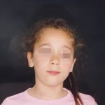 Fig. 2 Fotografia extra orale del volto: frontale a riposo.