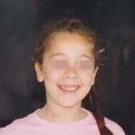 Fig. 3 Fotografia extra orale del volto: frontale col sorriso.