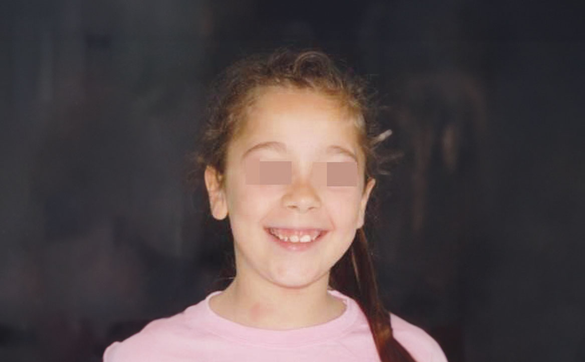 Fig. 3 Fotografia extra orale del volto: frontale col sorriso.