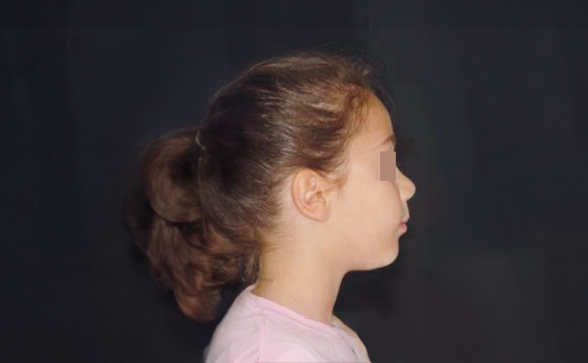 Fig. 4 Fotografia extra orale del volto: profilo.