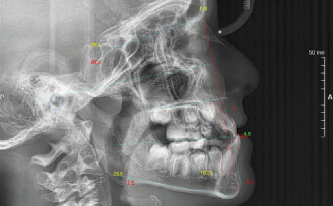 Fig. 3 Teleradiografia latero-laterale.