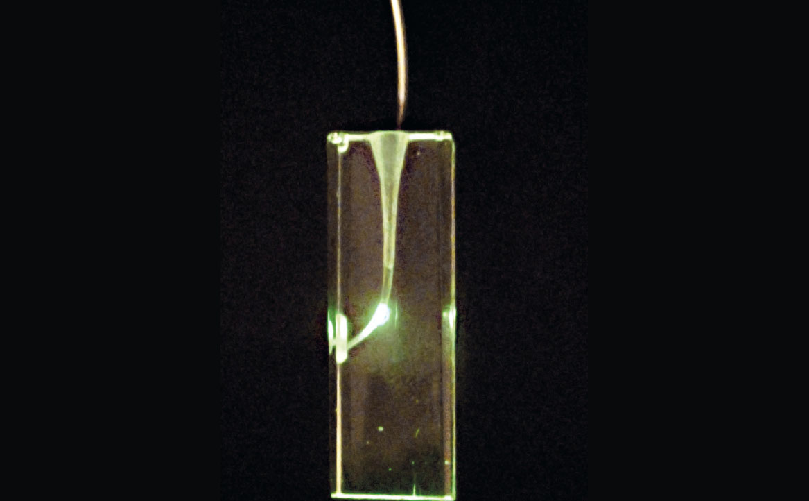 Fig. 2 Nd:Yag introduzione della fibra ad 1mm circa dall’apice.